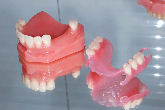 Съемные протезы для восстановления частично утраченных зубов