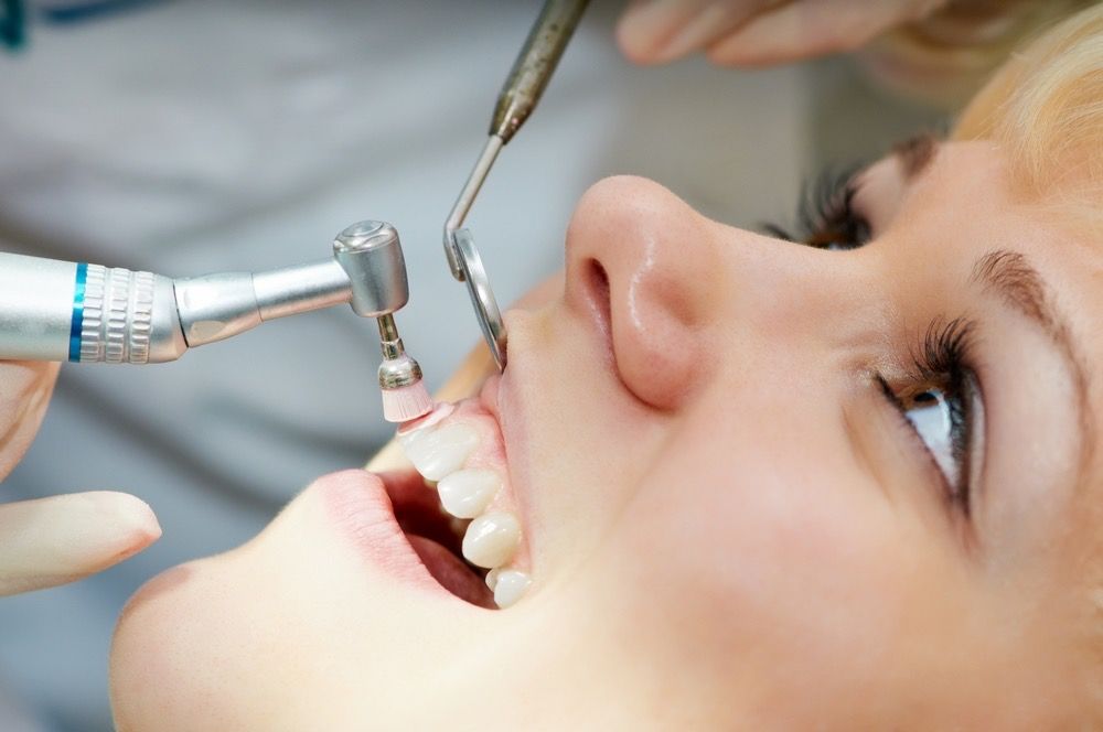 полировка зубов после минерализации